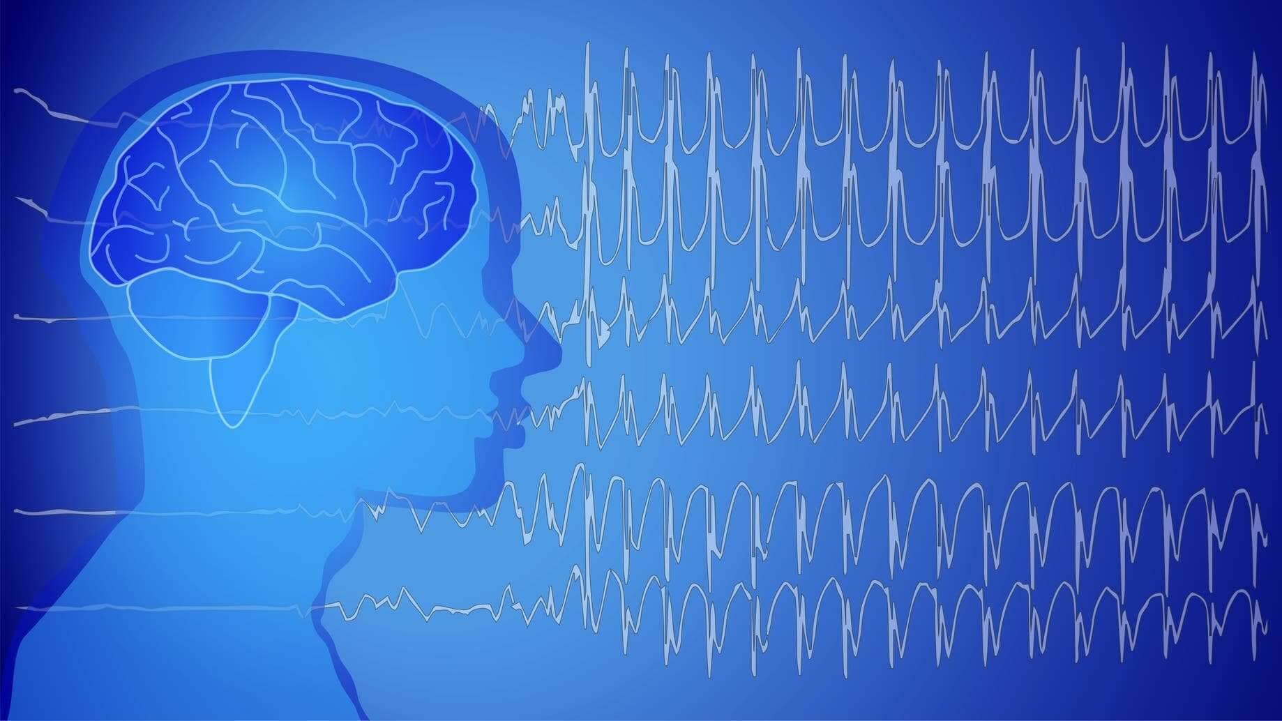 Donde realizan el examen electroencefalograma