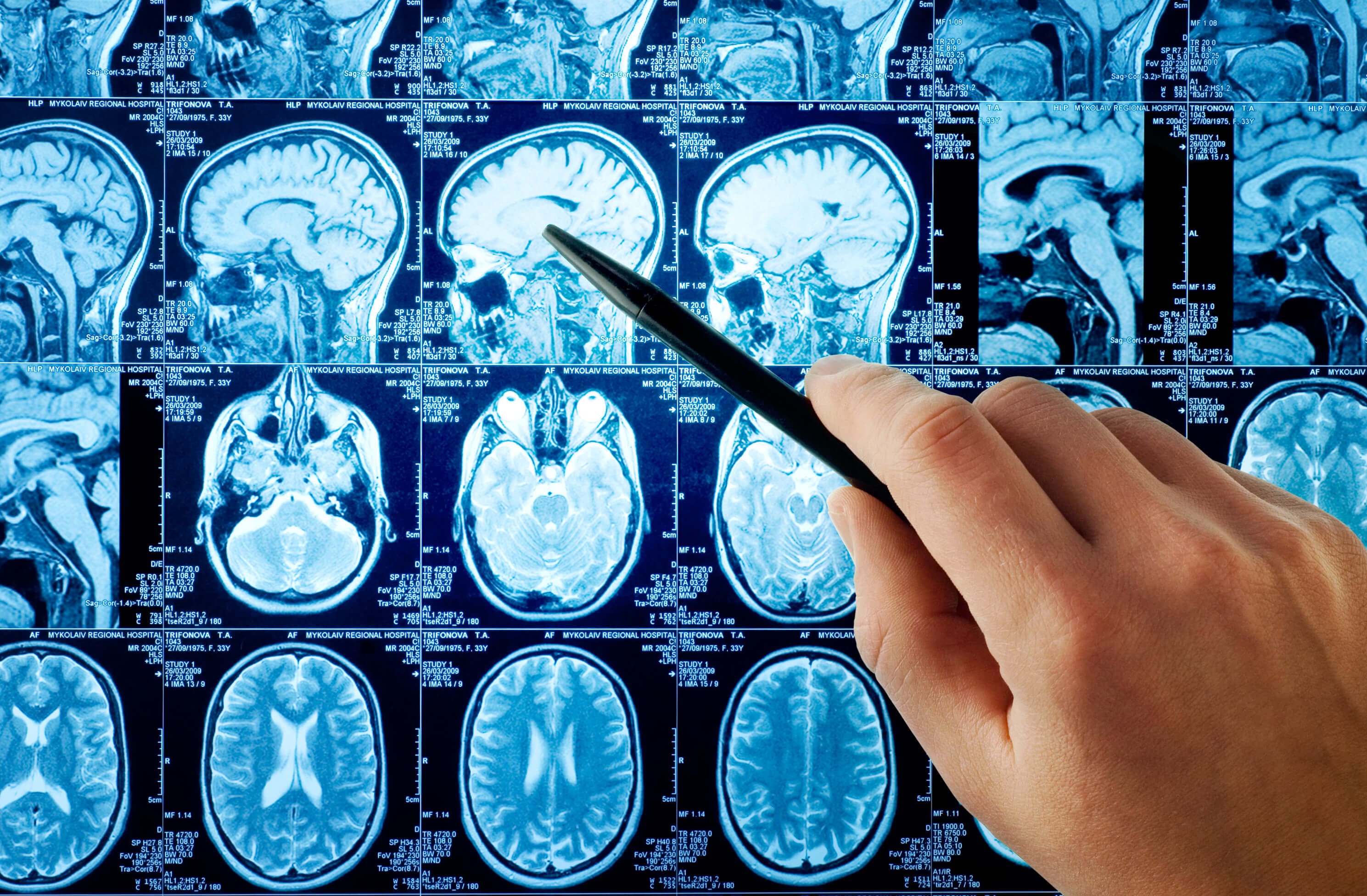 Precio de estudios de neurología pediátrica